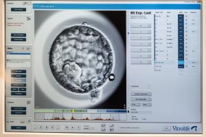 Smuk blastocyst (dag 5 æg) scores på Embryo Viewer, vha filmoptagelse af blastocysten. Blastocysterne gives point og gradueres. Blastocysten på højest antal point bruges først til ægoplægning.