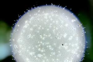 Sådan ser en sædprøve ud helt tæt på i mikroskopet. originale fotos af sædceller under mikroskopet taget på Afdeling for Vækst og Reproduktion. De smukke “cellemåner” har fået tilsat lidt farve, af hensyn til den grafiske effekt